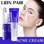 LION Paire de crème contre l'acné  24gr – Image 3