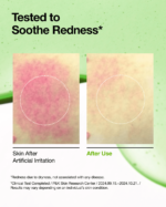 Anua Azelaic Acid 10 Hyaluron Redness Soothing Serum – 30ml – Image 3