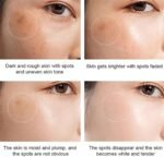 Dr Hancy White Spot Japan Cream – 20 g – Image 6