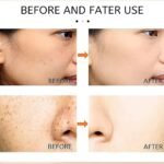 Dr Hancy White Spot Japan Cream – 20 g – Image 3