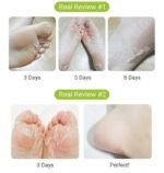 PUREDERM Masque Exfoliant pour les Pieds Shiny et Soft – 1 Paire – Image 3