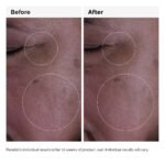 The Ordinary Sulfur 10% Powder to Cream 5g – Soin Cible Anti Acne & Purifiant – Image 3