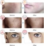 Masque Facial LED 7 Couleurs Visage et Cou – Phototherapie Anti Age & Raffermissante – Image 15