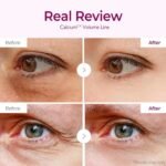 Dr Melaxin Cemenrete Calcium Volume Eye Patch 60 Patchs – Patchs Hydrogel Contour des Yeux Raffermissants et Hydratants – Image 2